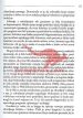 Ozdravimo bolečine hrbta - slika 11